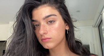 Ylli i TikTok, Dixie D’Amelio, flet mbi urrejtjen nga interneti